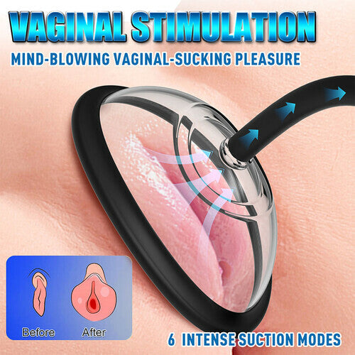 Acmejoy - Automatic Vacuum Nipple Pump & Vagina Pussy Pump With 5 Cups